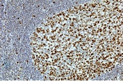 2 - Anti-KI67 Rabbit Monoclonal Antibody ABV11829