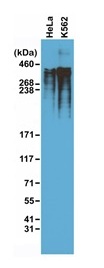 1 - Anti-KI67 Rabbit Monoclonal Antibody ABV11829