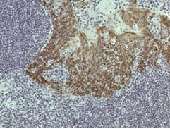 2 - Anti-Cytokeratin 5, Rabbit Monoclonal Antibody ABV11830