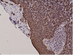 2 - Anti-Cytokeratin 5, Rabbit Monoclonal Antibody ABV11830