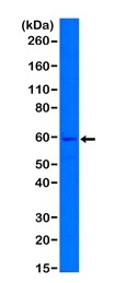 1 - Anti-Cytokeratin 5, Rabbit Monoclonal Antibody ABV11830