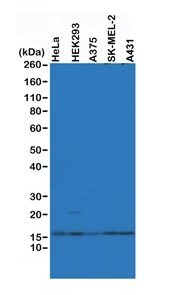 1 - Anti- Histone H2AZ, Rabbit Monoclonal Antibody ABV11836