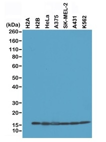 1 - Anti-Histone H2B Rabbit Monoclonal Antibody ABV11838