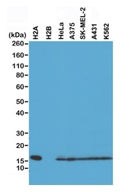 1 - Anti-Histone H2A Rabbit Monoclonal Antibody ABV11839