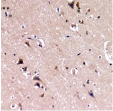 2 - Nephrin Antibody ABV11844