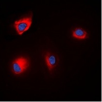 3 - Phospho-ANAPC1 (Ser688) Antibody ABV11850