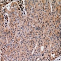 2 - Phospho-ANAPC1 (Ser688) Antibody ABV11850