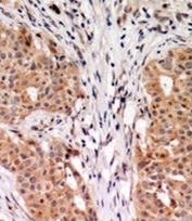 2 - RhoGDI Antibody ABV11855