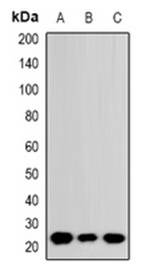 1 - RhoGDI Antibody ABV11855