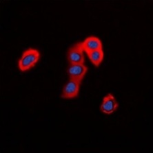 3 - Anti-ANO9 Antibody ABV11856