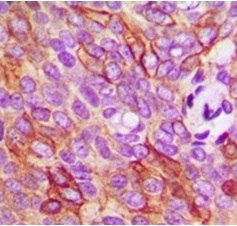 2 - Anti-ANO9 Antibody ABV11856