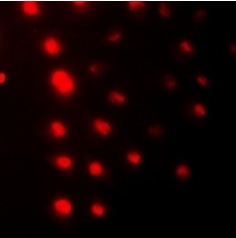 3 - Anti-ZNF7 Antibody ABV11857