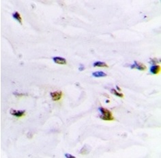 2 - Anti-ZNF7 Antibody ABV11857