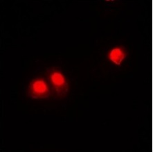 3 - Anti-CHD4 Antibody ABV11860