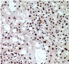 2 - Anti-CHD4 Antibody ABV11860
