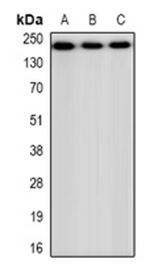 1 - Anti-CHD4 Antibody ABV11860