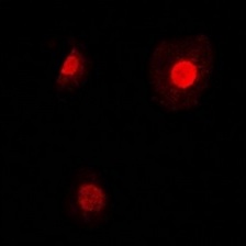 3 - Anti-TEAD2 Antibody ABV11861
