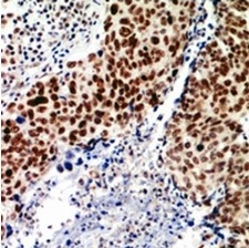 2 - Anti-TEAD2 Antibody ABV11861