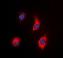 3 - Anti-Tensin 3 Antibody ABV11862