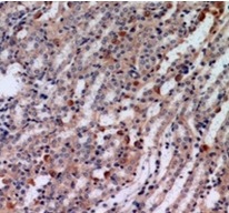 2 - Anti-Tensin 3 Antibody ABV11862