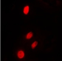 3 - Anti-TP53INP2 Antibody ABV11863