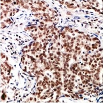 2 - Anti-TP53INP2 Antibody ABV11863