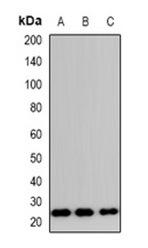 1 - Anti-TP53INP2 Antibody ABV11863