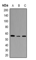1 - Anti-STEAP2 Antibody ABV11864