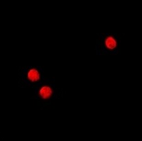 3 - Anti-TSHZ2 Antibody ABV11865