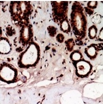 2 - Anti-TSHZ2 Antibody ABV11865
