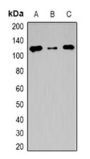 1 - Anti-TSHZ2 Antibody ABV11865