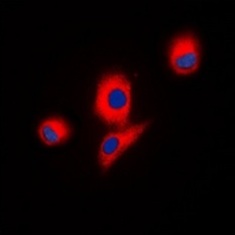 3 - Anti-ICK Antibody ABV11866