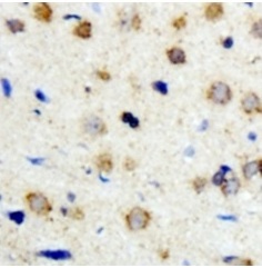 2 - Anti-ICK Antibody ABV11866