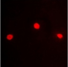 3 - Anti-ZKSCAN5 Antibody ABV11867