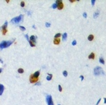 2 - Anti-ZKSCAN5 Antibody ABV11867