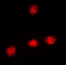 3 - Anti-XRCC3 Antibody ABV11870