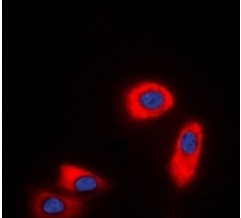 3 - Anti-CHST9 Antibody ABV11871