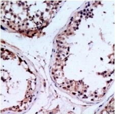 2 - Anti-CHST9 Antibody ABV11871