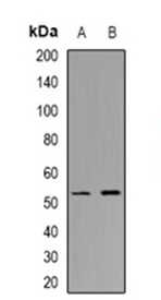 1 - Anti-CHST9 Antibody ABV11871