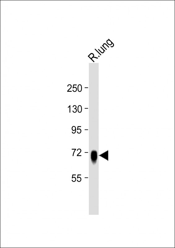 1 - ST7 Antibody (Center) AP10493c