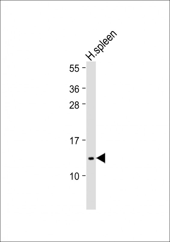 1 - IFI27 Antibody (C-Term) AP22279b