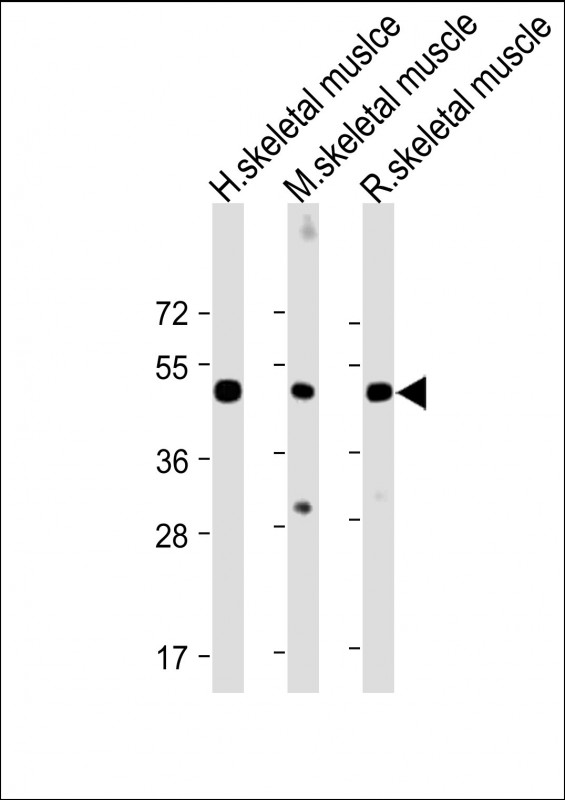 1 - CHRNE Antibody (Center) AP22287c