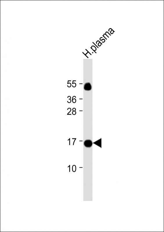 1 - TTR Antibody (C-term) AP6698b