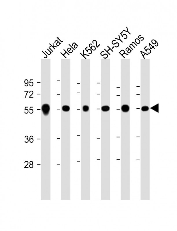 1 - CALR Antibody (Center) AP6898C