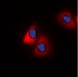 3 - Anti-MARCH2 Antibody ABV11872