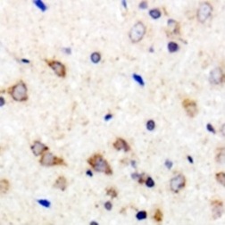 2 - Anti-MARCH2 Antibody ABV11872