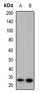 1 - Anti-MARCH2 Antibody ABV11872