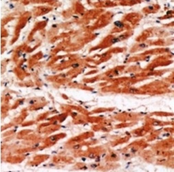 2 - Anti-MYBPC3 Antibody  ABV11876