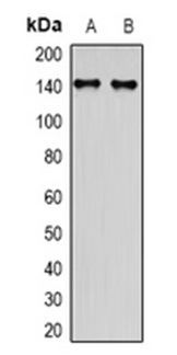1 - Anti-MYBPC3 Antibody  ABV11876