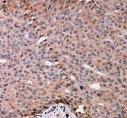2 - Anti-TRAK2 Antibody ABV11880